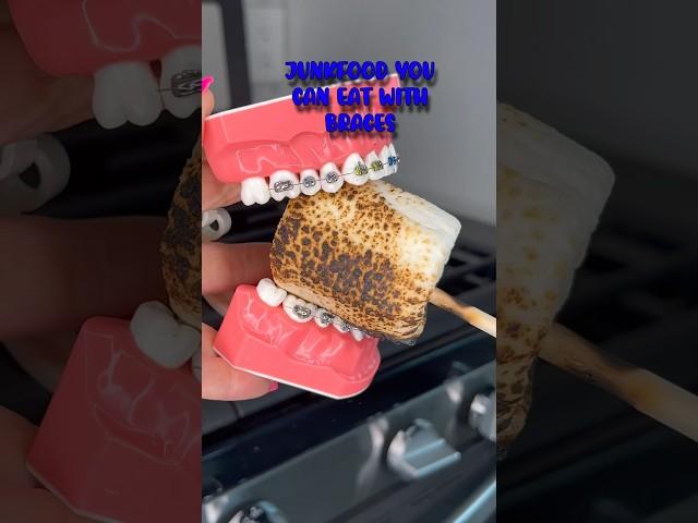 JUNKFOOD YOU CAN EAT WITHOUT BREAKING BRACES OFF  ORTHODONTIST REACTS TO UNHEALTHY SNACKS 