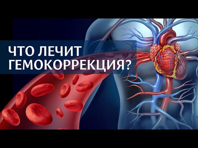 Что лечит экстракорпоральная гемокоррекция крови?