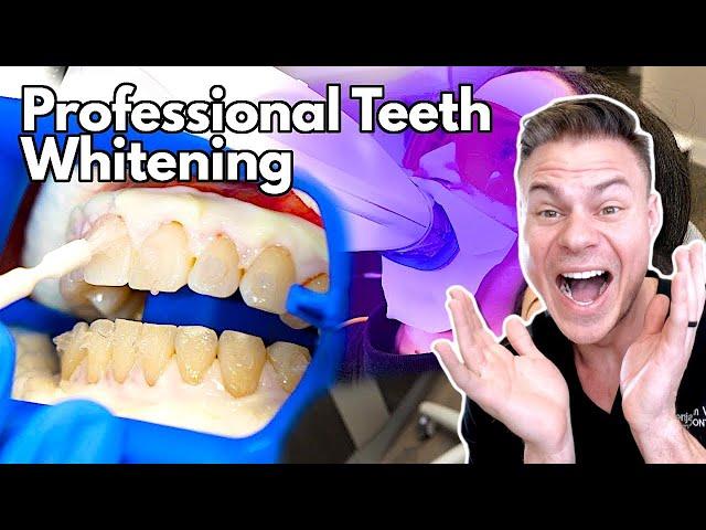 How Teeth Whitening At The Dentist Works...And Is It Worth It? Orthodontist Reacts!