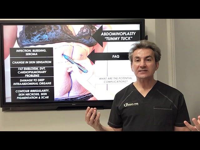 What are the potential complications of tummy tuck surgery by Dr. Iraniha