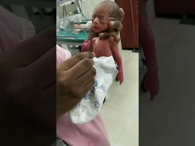 baby of five months  ##weight 400grams ## male baby #soo cute small baby##baby is serious plz help 