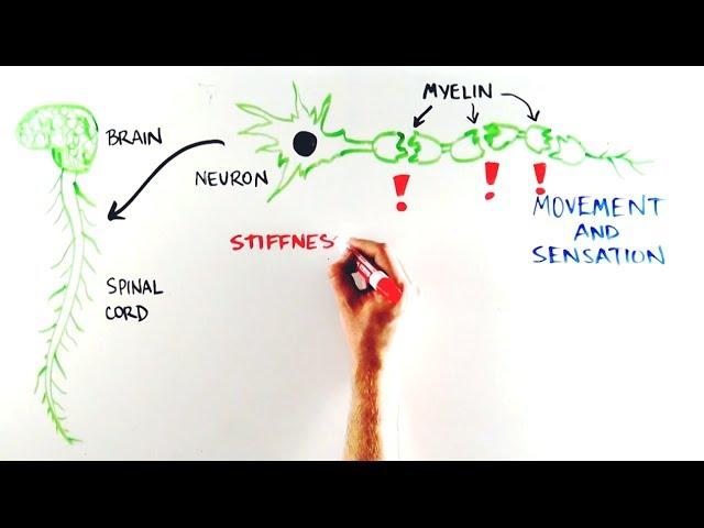 WHAT IS ALD? Adrenoleukodystrophy explained.