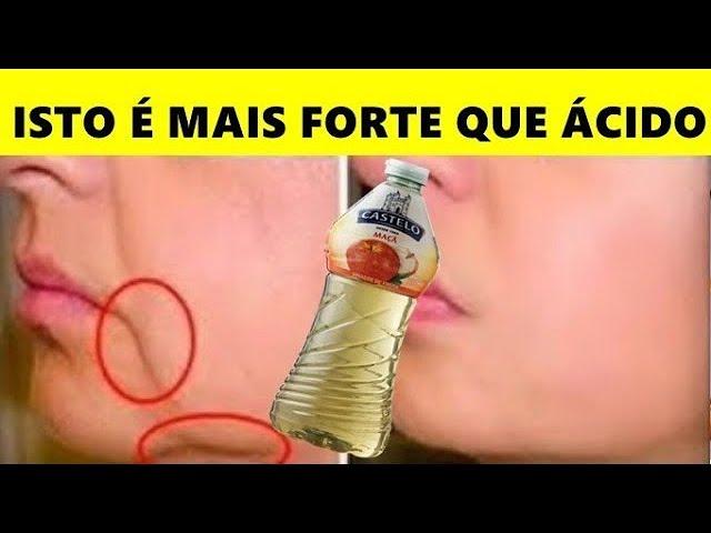 ISTO ESTICA a PELE FLÁCIDA, REMOVE MANCHAS e FECHA POROS ABERTOS