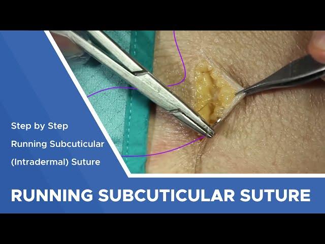 Running Subcuticular (Intracutaneous) Suture: Step by Step Instructions