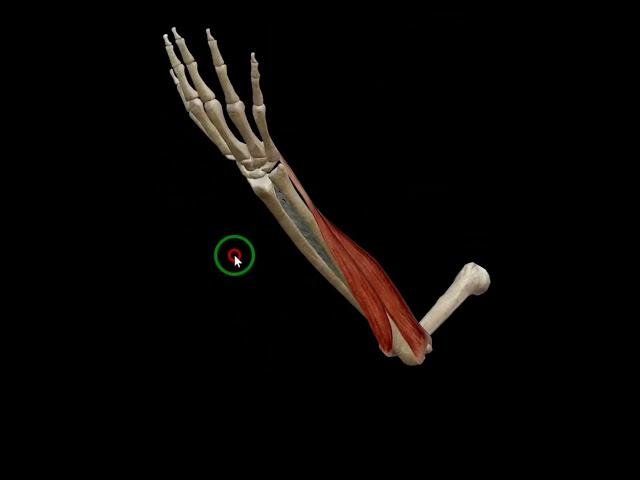 Wrist adduction