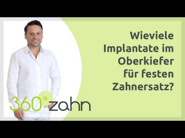 Wie viele Implantate im Oberkiefer für festen Zahnersatz? | Implantate | Fragen & Antworten 360°zahn