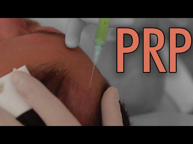 Can PRP Treatment Regrow Hair? | Dr Balwi Explains