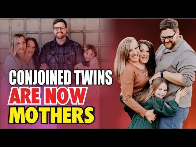 IT'S CONFIRMED!! Conjoined Twins Abby & Brittany Are MOTHERS Now!!