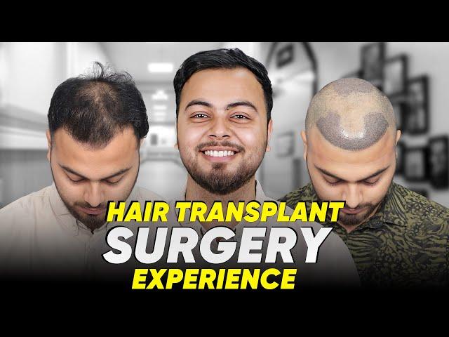 Hair Transplant in Chandigarh | Best Results & Cost of Hair Transplant in Chandigarh