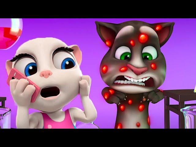 Talking Tom  Llama al doctor  Super Toons TV Dibujos Animados en Español