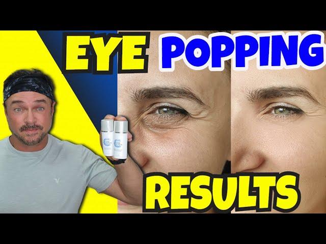 Make Your Eye Skin Look YOUNGER Fast With 2 Steps!