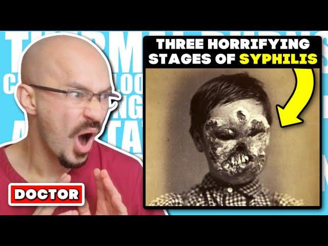 DOCTOR Reacts to The Three Horrifying Stages of Syphilis