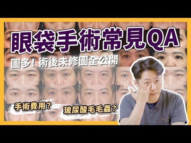 【必看】2024最新眼袋QA️手術多少錢？降低術後瘀青？外修皮留疤？｜台南杰美學 周杰醫師