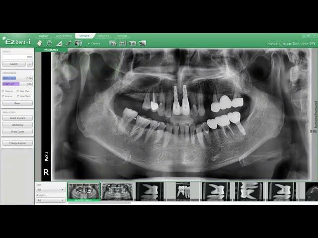 Vatech EzDent-i Intro - 2D Software
