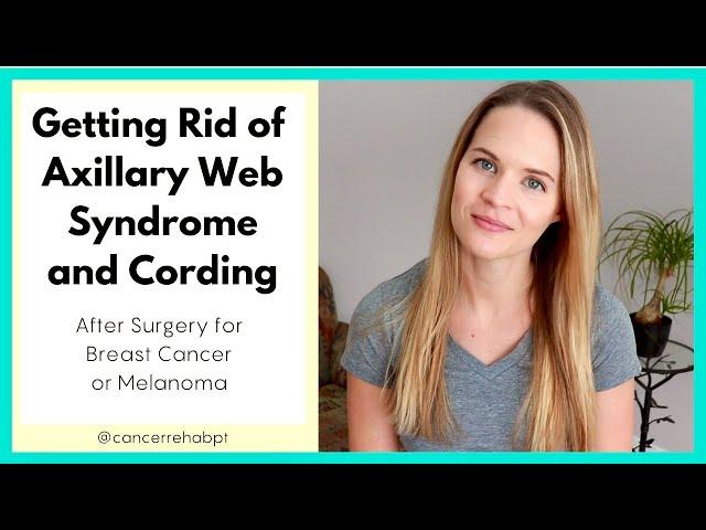 Getting Rid of Axillary Web Syndrome and Cording after Breast or Melanoma Cancer Surgery