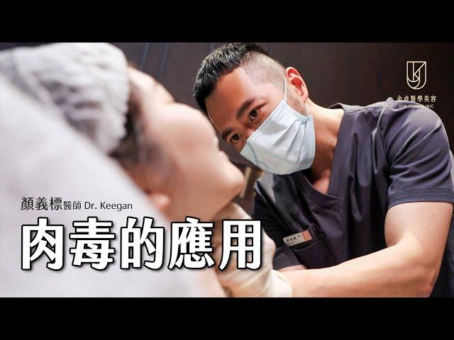 【微整形美學】肉毒的應用｜Dr.Keegan #顏義標醫師｜金貞醫學美容