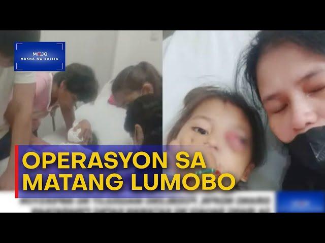 Mukha Ng Balita | 2-anyos na babae sa CamSur, lumobo ang mata dahil sa sirang ngipin