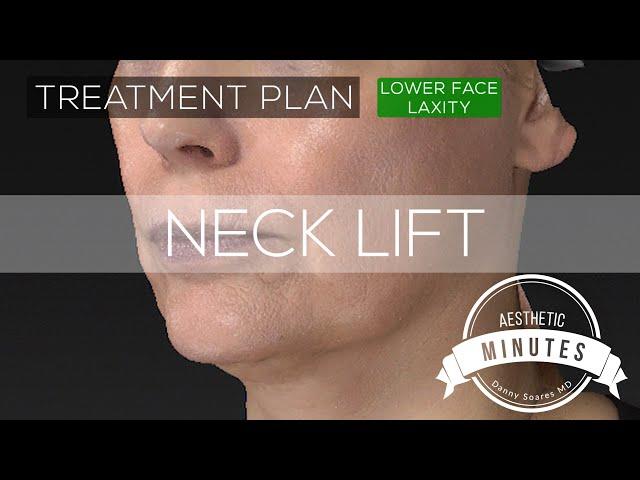 48 yo Female Neck Lift - Turning Back the Clock | Aesthetic Minutes #Necklift