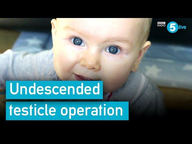 Undescended testicle operation: A parent's advice