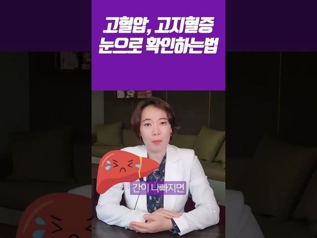 고혈압, 고지혈증! 눈으로 확인할 수 있다?