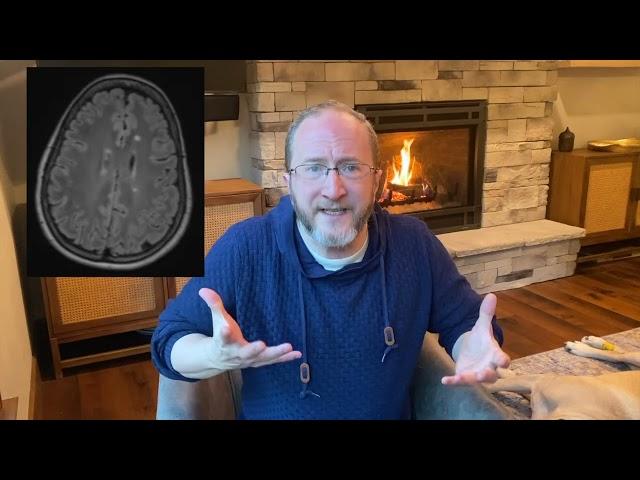 Why Worse? A Multiple Sclerosis Neurologist Explains