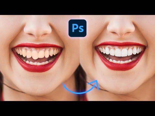 Perfect Smile - Short Photoshop Tutorial