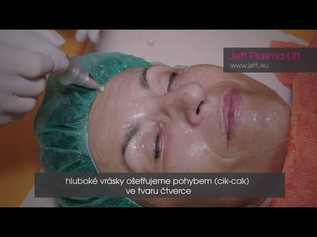 Jett Plasma Lift - ošetření obličeje