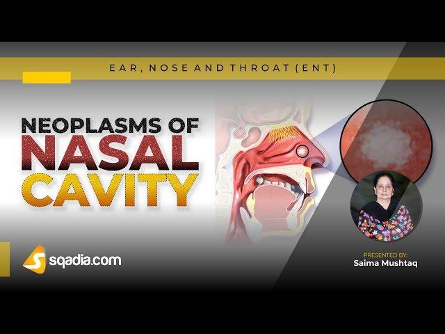 ENT Lecture | Neoplasms of Nasal Cavity | Medical Student V-Learning