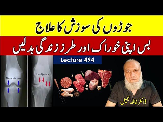 Osteoarthritis can be reverse by life style changes | lecture 494