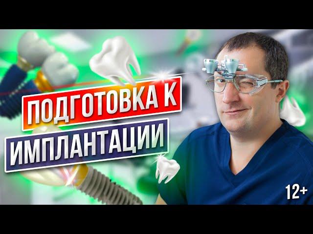 Как Подготовиться к Имплантации Зубов Правильно [Этапы Подготовки]
