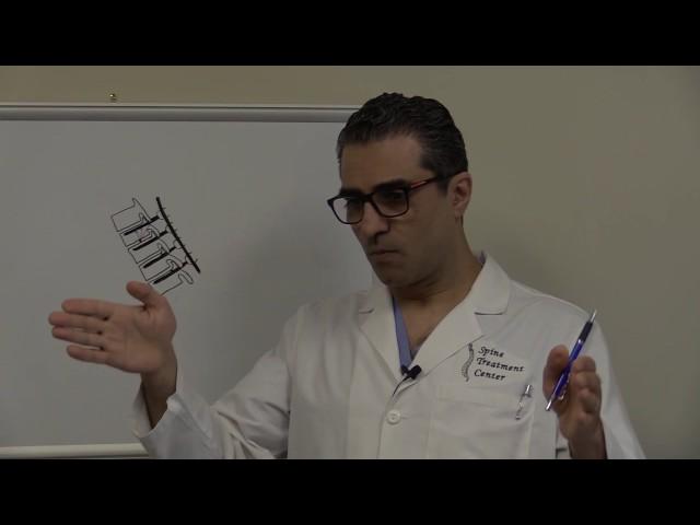 Biomechanics of pedicle screw and how they fail