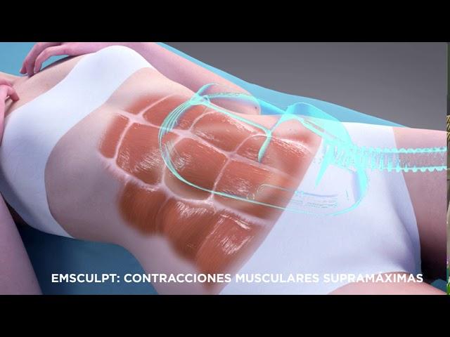 Emsculpt® - Mecanismo de acción