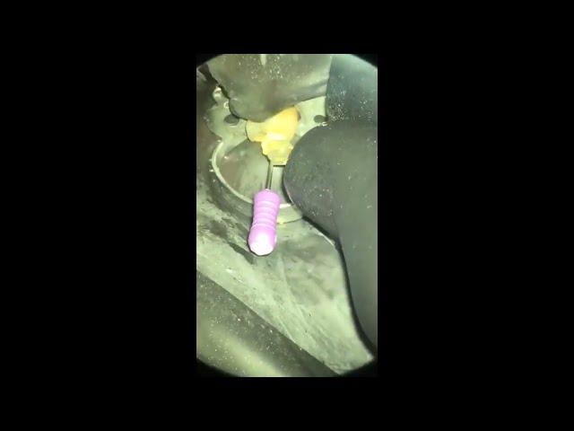 2021-05-18 Случай с истинной облитерацией канала