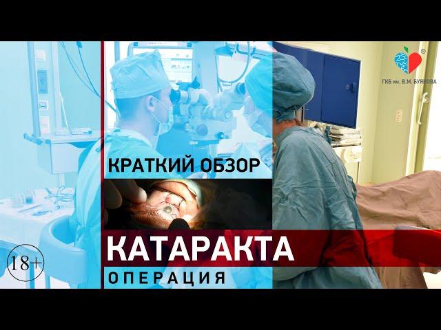 Удаление катаракты (краткий обзор, рассказывает врач-офтальмолог Ильюхин О.Е.)