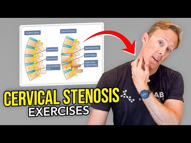 5 Exercises for Cervical Stenosis (Arm Nerve Pain)