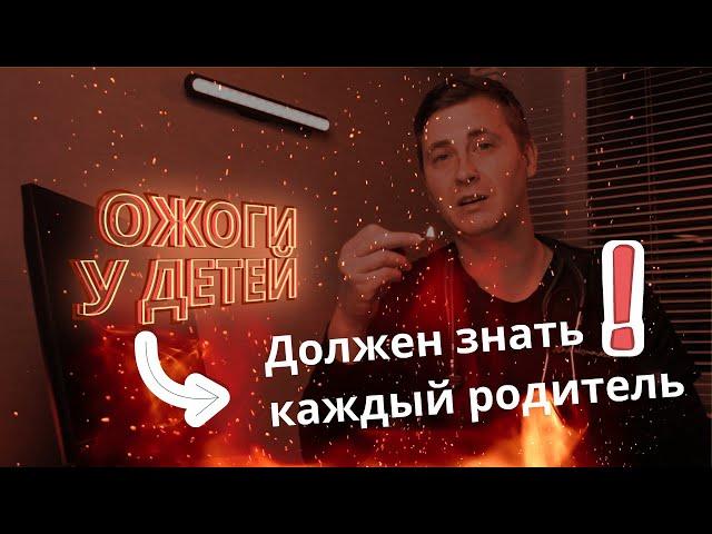 ОЖОГ у ребенка | Первая ПОМОЩЬ при ожоге у малыша | Как УБЕРЕЧЬ ребенка от ОЖОГОВ