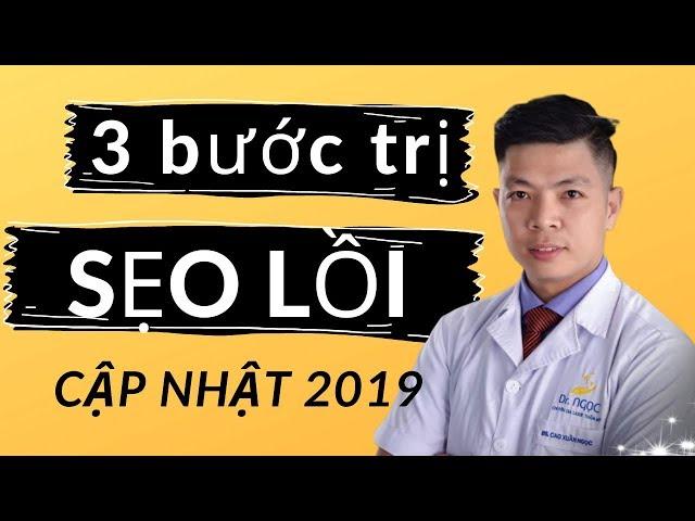 Điều trị SẸO LỒI cập nhật 2019, công thức được tiết lộ từ GS, Bác sỹ Bệnh Viện 108