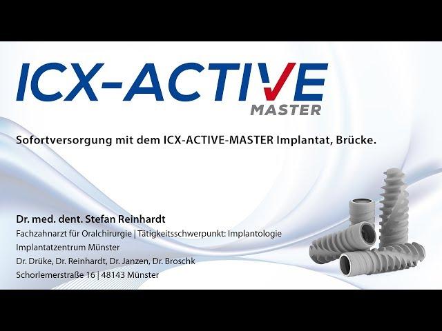 Brücken-Sofortversorgung mit dem ICX-ACTIVE-MASTER Implantat