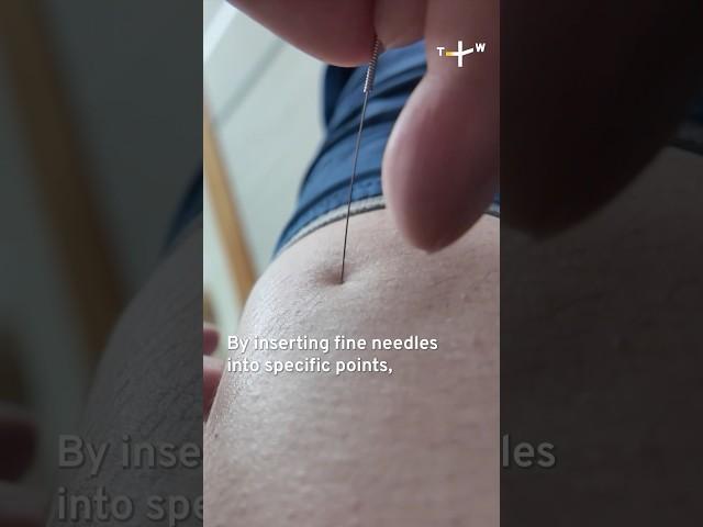 How does acupuncture work? | Decoding Eastern Science: The Pulse #shorts