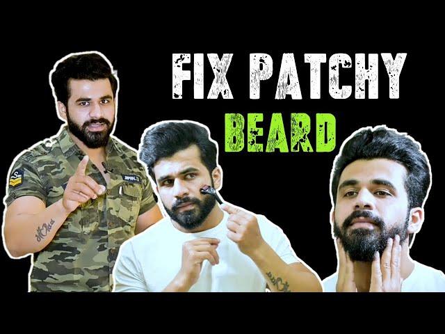 Fix PATCHY BEARD !