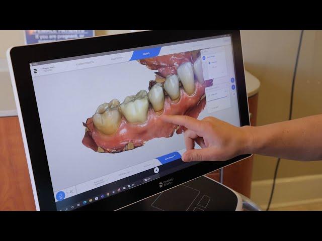 Ease of Use - CEREC Primescan