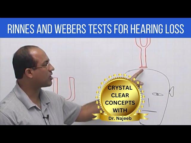 Rinnes and Webers Tests for Hearing Loss | ENT