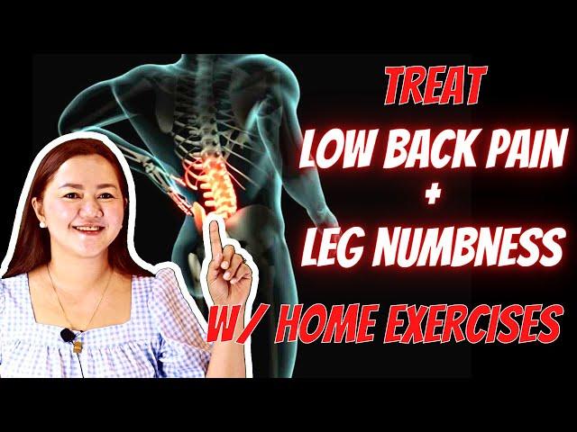 Treating Lumbar Spondylosis with Home Exercises | Doc Cherry