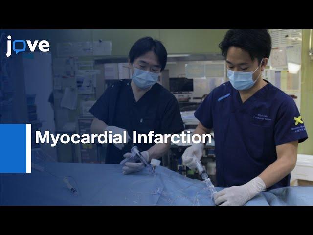 Myocardial Infarction Elevation with Lactate Blood: Cardioprotection | Protocol Preview