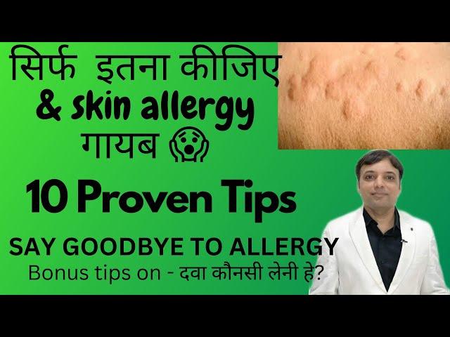 10 Tips for Skin allergy treatment at home| स्किन एलर्जी को जल्दी ठीक करने की १० टिप्स Dermatologist