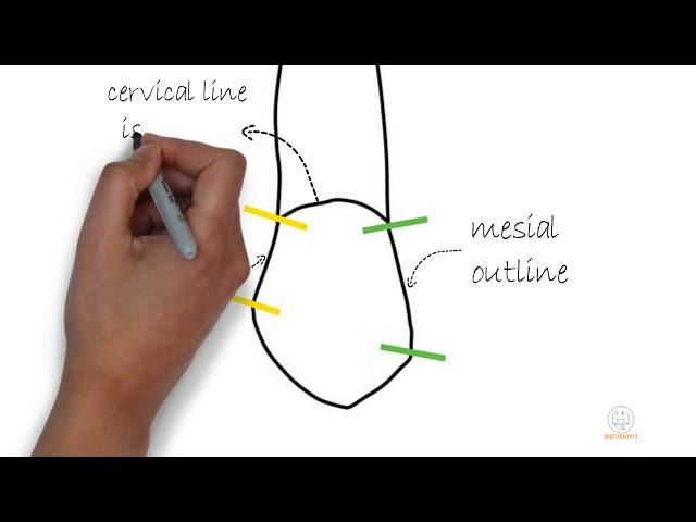 Permanent Maxillary Canine