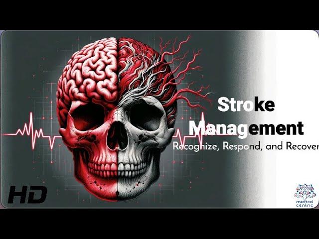 Stroke 911: Immediate Actions That Can Save Lives