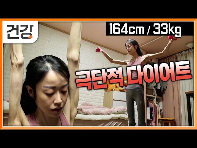 성인 몸무게가 33kg? | 극단적 마른 몸매를 추구하는 사람들 | 나에게 맞는 다이어트란 무엇일까? | 내몸사용설명서 | #EBS건강