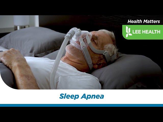 Sleep Apnea