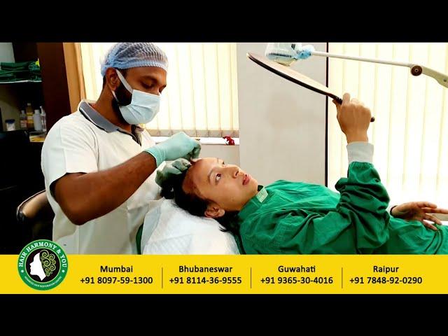 Female Hair Transplant Results | HHY Best hair transplant in Guwahati Assam | Hair transplant cost